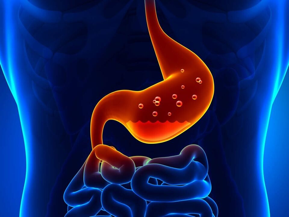La gastritis es una enfermedad inflamatoria del estómago que requiere nutrición